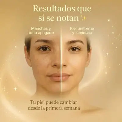 Serum Activo- Para Manchas, Marcas y Cicatrices KIT X2 UNIDADES